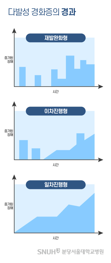 다발성 경화증의 경과