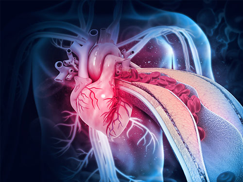 가슴이 아프면 심혈관질환 의심해야, 협심증과 심근경색